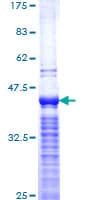 Human MKI67 / Ki67 Protein (Recombinant GST, N-terminus)