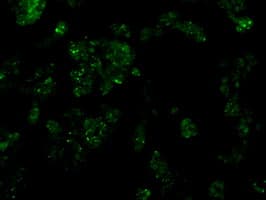 IHC-plus™ SRR / Serine Racemase Antibody (clone 9E8)