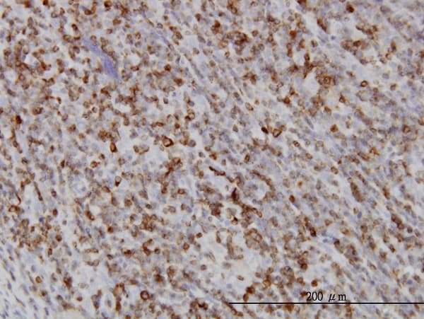 RAB27A / RAB27 Antibody (clone 1G7)