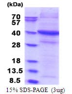 Human SIRPG Protein (Recombinant His)