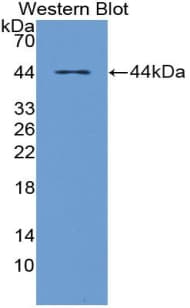 CD2AP Antibody (aa149-429, APC)