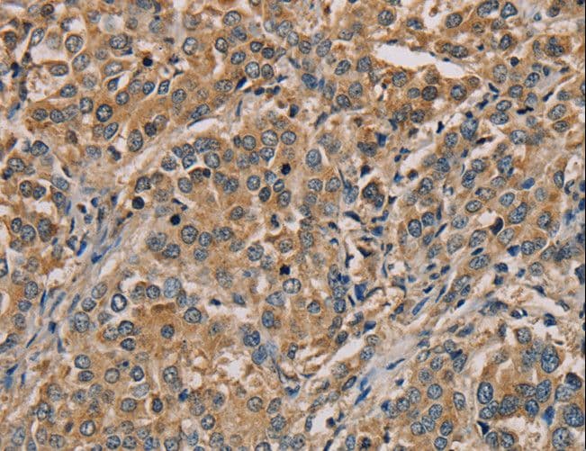 NANOS2 / NOS2 Antibody