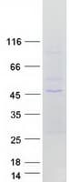 Human GNA11 Protein (Recombinant Myc-DDK (Flag))