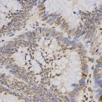 Histone H3 Antibody (Tri-Methyl-Lys79)