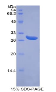 Human ABCG1 Protein (Recombinant His)