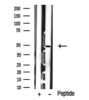 MAP2K1 / MKK1 / MEK1 Antibody