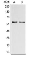 DOK2 Antibody (phospho-Tyr299)