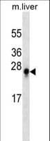 Monoclonal Mouse anti-Mouse S100B / S100 Beta Antibody (WB)