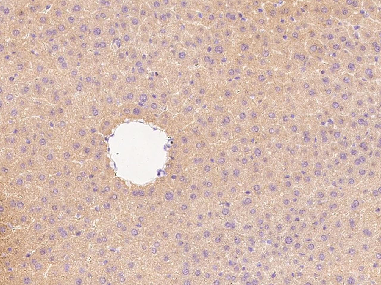 Polyclonal Rabbit anti-Mouse PCSK9 Antibody (Preservative Free, IHC)