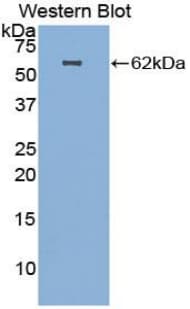 HGF / Hepatocyte Growth Factor Antibody (aa32-291)