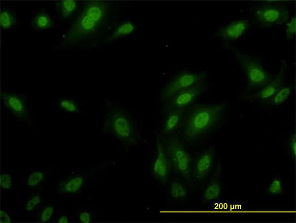 RPL9 / Ribosomal Protein L9 Antibody (clone 2F11)