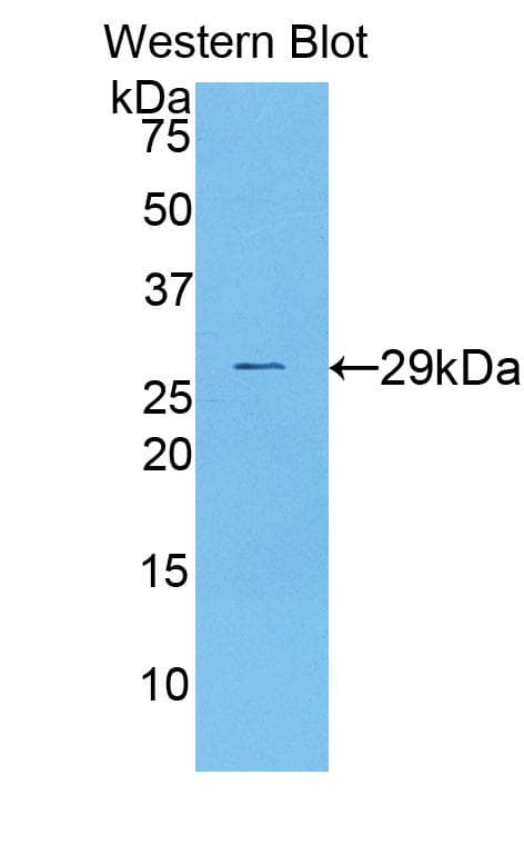 DLAT / PDC-E2 Antibody (aa368-626)