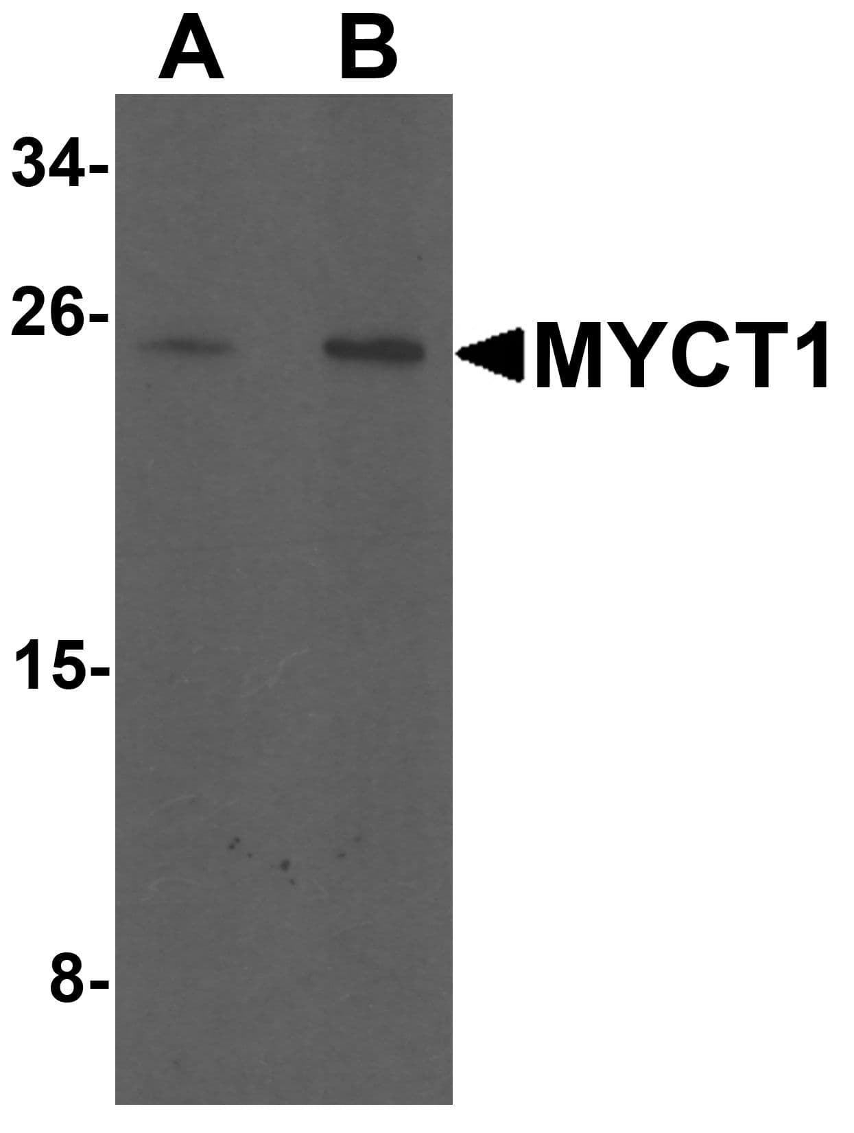 Polyclonal Rabbit anti-Human MYCT1 Antibody (WB)