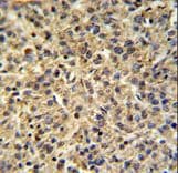 Polyclonal Rabbit anti-Human TPRG1L Antibody (aa35-63, IHC, WB)
