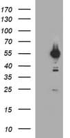 TUBA1B / Tubulin Alpha 1B Antibody (clone OTI3G3, Carrier-free)