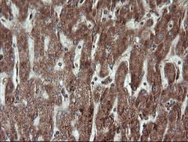 Monoclonal Mouse anti-Human TRAPPC4 / Synbindin Antibody (clone OTI2G8, IHC, WB)