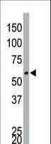 Polyclonal Rabbit anti-Human DYRK4 Antibody (aa455-485, WB)