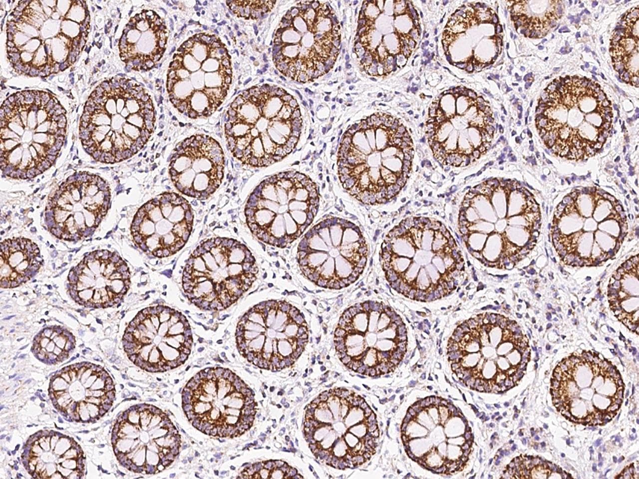 Polyclonal Rabbit anti-Human MRPS26 Antibody (IHC, IF, WB)