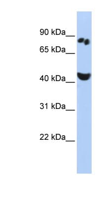 WT5 / POU6F2 Antibody (aa35-84)