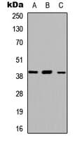 ABHD13 Antibody (Internal)