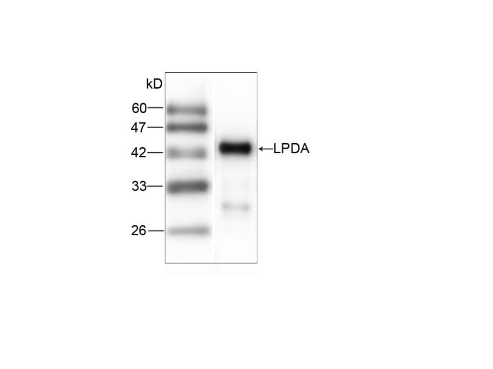 Neisseria meningitidis LPDA Antibody (aa332-469)