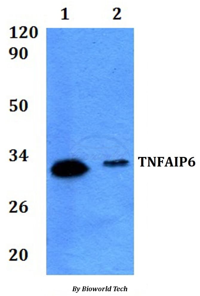 Polyclonal Rabbit anti-Human TNFAIP6 / TSG-6 Antibody (WB)