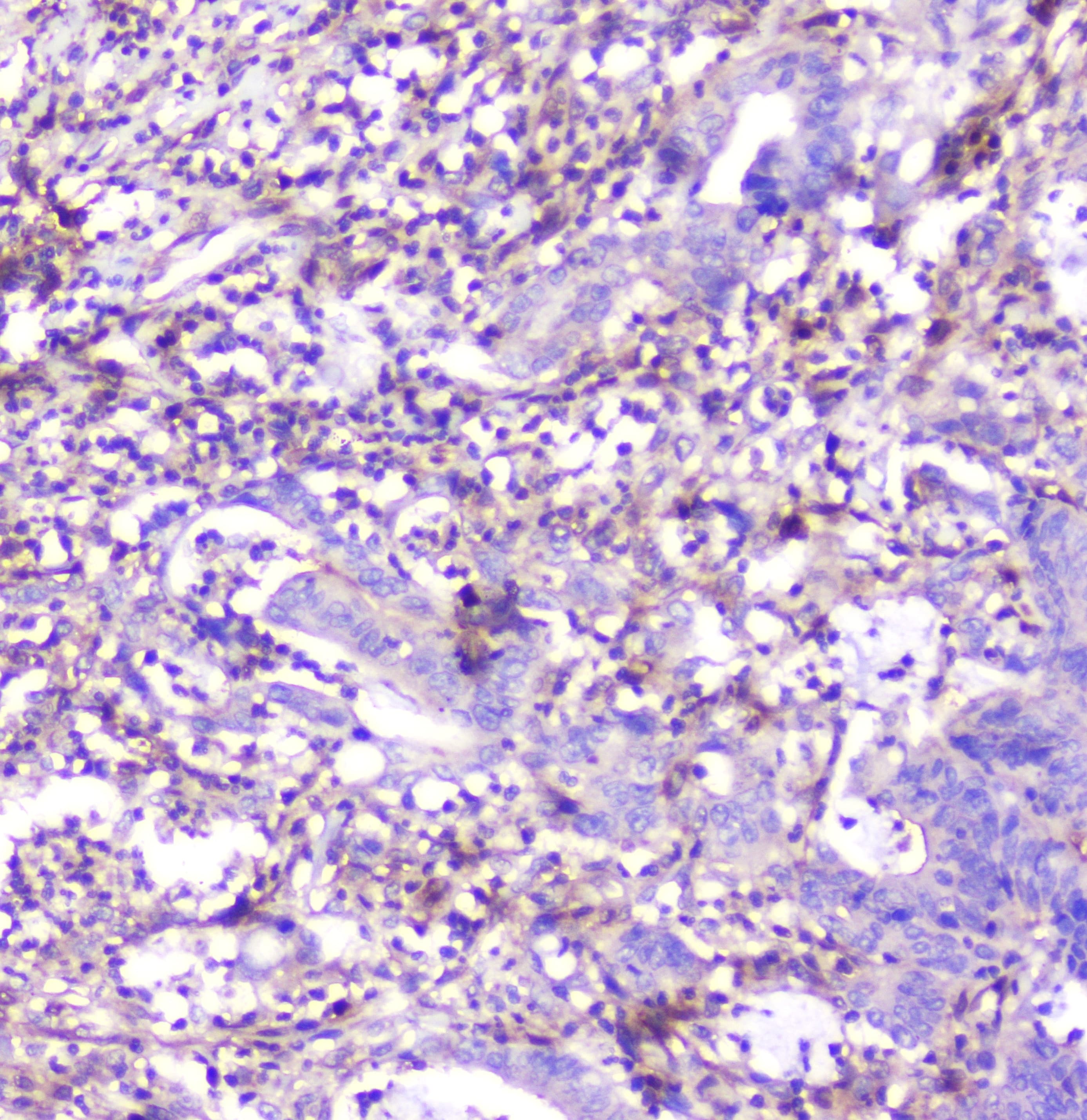 ADA / Adenosine Deaminase Antibody