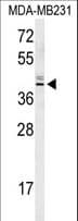 KLHDC2 / LCP Antibody (aa293-320)