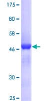 Human MRE11A / MRE11 Protein (Recombinant GST)