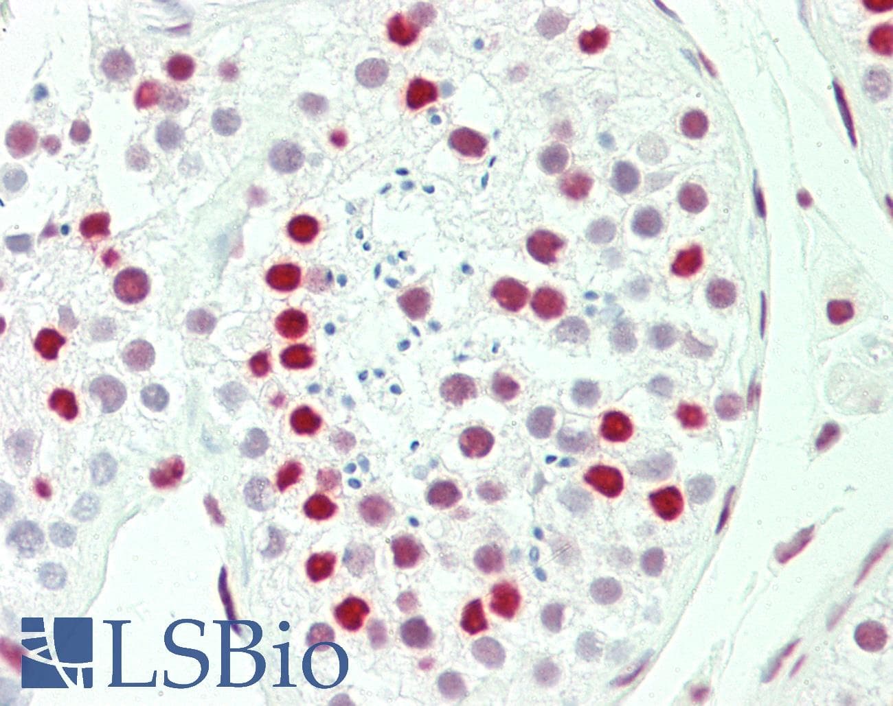 IHC-plus™ QKI Antibody (C-Terminus)