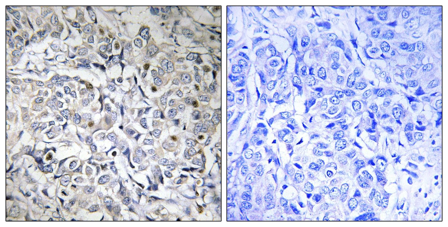 RELA / NFKB p65 Antibody (phospho-Thr505)