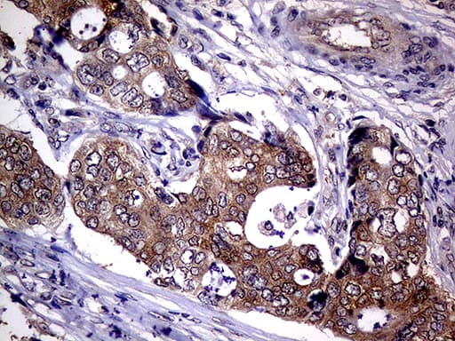Monoclonal Mouse anti-Human UPRT Antibody (clone OTI1D12, Carrier-free, IHC, WB)