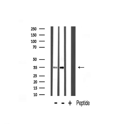 SYP / Synaptophysin Antibody