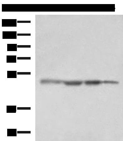 Polyclonal Rabbit anti-Human RHAG Antibody (IHC, WB)