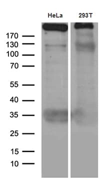 Monoclonal Mouse anti-Human TP53BP1 / 53BP1 Antibody (clone OTI6D9, aa1-300, IHC, WB)