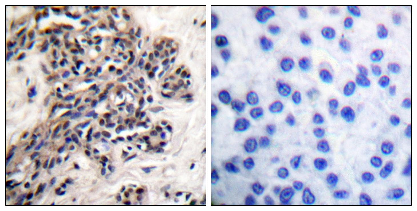 NFKBIB / IKB Beta / IKBB Antibody (phospho-Ser23)