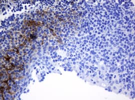 TAPBPL / TAPBPR Antibody (clone OTI5E5)