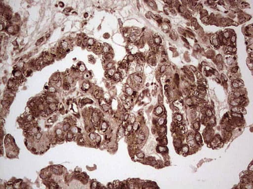 YBX1 / YB1 Antibody (clone OTI7B4)
