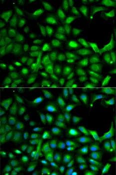 IGF2 Antibody