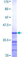 Human MUS81 Protein (Recombinant GST, N-terminus)