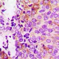 FAK / Focal Adhesion Kinase Antibody (phospho-Tyr397)