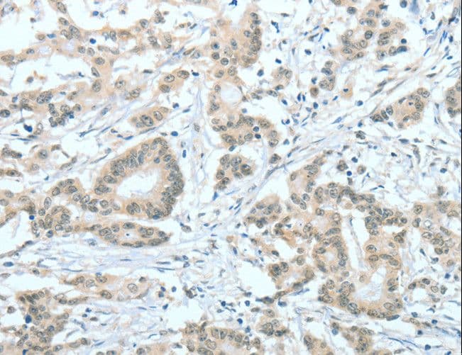 ASH2L / ASH2 Antibody