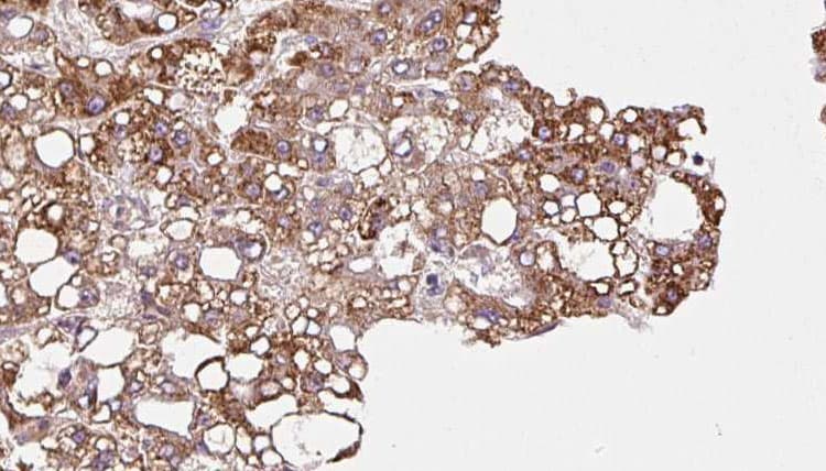 MPP5 Antibody