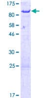 Human ACSS2 / ACAS2 Protein (Recombinant GST)