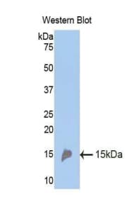 REN / Renin 1 Antibody (aa110-221, PE)