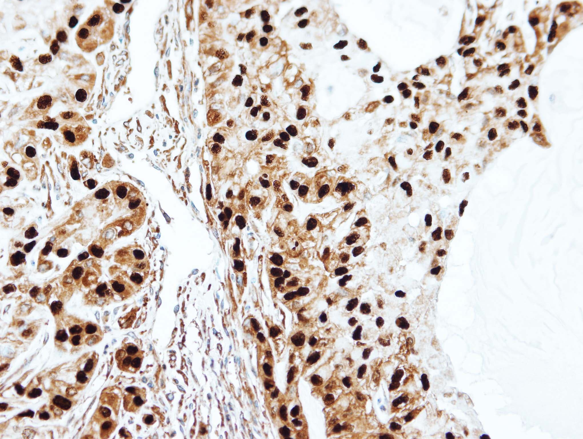 Polyclonal Rabbit anti-Human SET / TAF-I Antibody (aa1-45, IHC, WB)