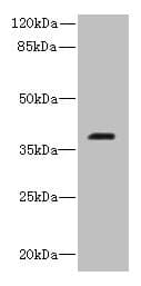 Polyclonal Rabbit anti-Human RIBC2 Antibody (IHC, WB)