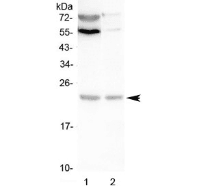 Polyclonal Rabbit anti-Human LMO2 Antibody (WB)