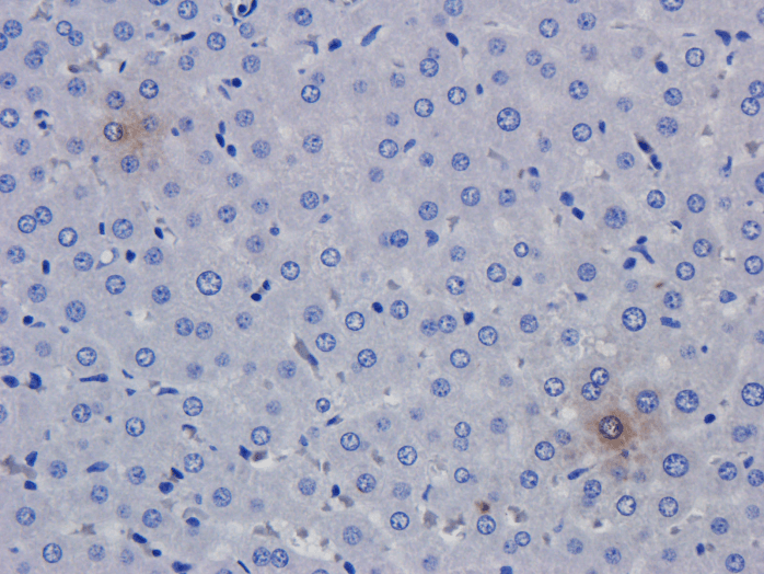 TNF Alpha Antibody (TNF alpha, clone CDP 571 (Humicade))