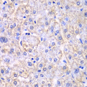 EHHADH / Enoyl-Coa Hydratase Antibody